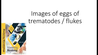 Images of Trematode Eggs [upl. by Nitreb401]