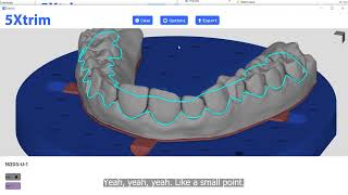 5Xtrim Aligner Trimming  AIgenerated Automatic Trimline [upl. by Soraya]