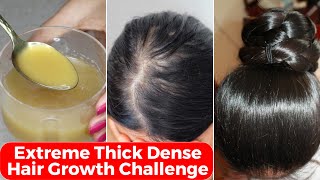 30 Days Extreme Thick Hair Growth ChallengeIncrease Hair Density amp thicknessपतले बालों को घना करे [upl. by Arita]