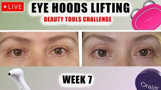 EYE HOODS LIFTING  WEEK 7  ORALIFT SPRING SALE [upl. by Higley]