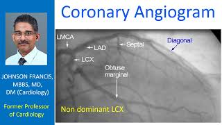 Coronary Angiogram [upl. by Ardnek]