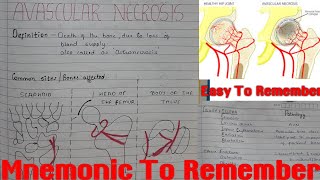 Avascular Necrosis  AVN  Everything You Should Know  Easy To Remember With Mnemonic [upl. by Auqinehs119]