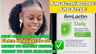 AMLACTIN BEFORE AND AFTER  HONEST TALK ABOUT AMLACTIN LOTION [upl. by Namyaw57]