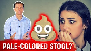 What Does PaleColored Poop Mean – DrBerg [upl. by Molly764]