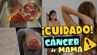 Cáncer de mama Causas síntomas y tratamientos [upl. by Noletta853]