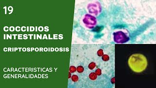 Coccidios Intestinales 19 Criptosporidiosis  Criptosporidium Parvum  Apicomplexas [upl. by Arimaj82]