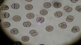 Mitose comment identifier les differents stades de division cellulaire sous le microscope [upl. by Nereus]