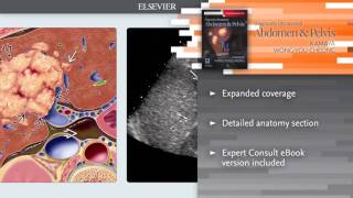 Diagnostic Ultrasound Abdomen and Pelvis [upl. by Gaal]