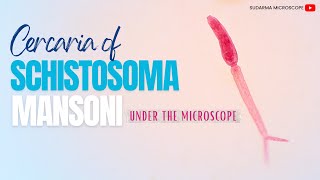 Schistosoma mansoni cercariae under the microscope [upl. by Onairelav]