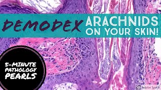 Demodex Tiny Arachnids living on your skin [upl. by Nera]