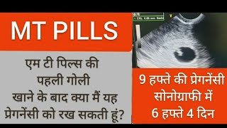 MT pills की 5 गोलियों में से पहली गोली खाने के बाद क्या मैं प्रेगनेंसी को रख सकती हूं  MT PILLS [upl. by Sabelle]