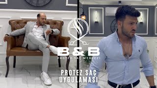 PROTEZ SAÇ UYGULAMASI  YAŞAM TARZINI DEĞİŞTİR [upl. by Tallie644]