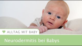 Neurodermitis bei Babys So erkennst du es [upl. by Neda307]