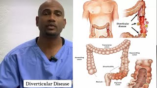 DIVERTICULAR DISEASE 🦠  Dr Dawes Explains🦠 [upl. by Mata600]