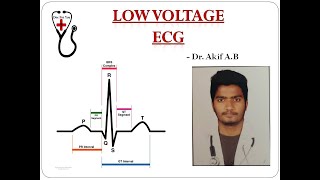 Low Voltage ECG  Dr Akif Baig [upl. by Naihs]