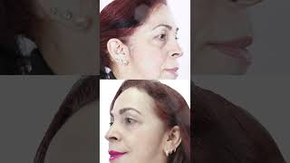 2 formas de aplicar el corrector  TUMAKEUP [upl. by Fotina]