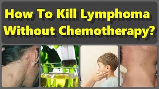 How To Kill Lymphoma Without Chemotherapy But With The Natural Remedies [upl. by Yeneffit]