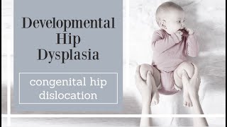 Developmental Hip Dysplasia  congenital hip dislocation [upl. by Trabue]