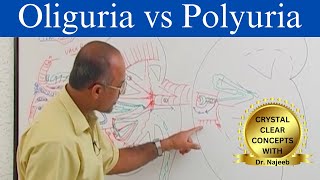 Oliguria vs Polyuria  Urine Output  Causes and Symptoms [upl. by Yelyac597]