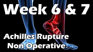 Achilles Rupture Update  Week 6 amp 7  Exercises Stretches Support Groups  Non Surgical [upl. by Nanji508]