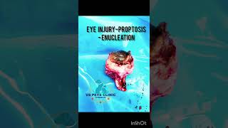 Eye injuryproptosis Enucleation [upl. by Hudnut]