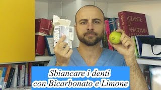 video sbiancamento [upl. by Assilram]