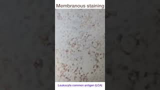 ImmunohistochemicalIHC Stains mbbs IndhujaMBBS [upl. by Novehc]