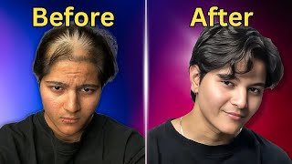 How To Stop Hair Fall And Regrow Hair [upl. by Genet]