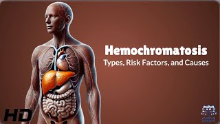 Hemochromatosis Risk Factors Are You at Risk [upl. by Roshelle]