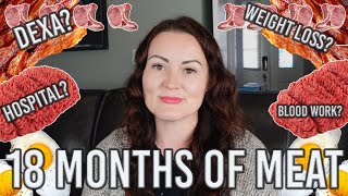 18 Month Carnivore Update Weight Loss Stall CGM Data Hospital Stay [upl. by Nevanod792]