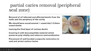 biomimetics2caries removal strategies [upl. by Rochkind92]