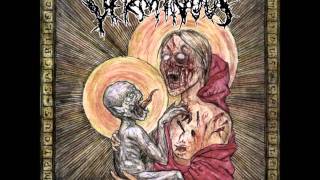 VERMINOUS  Impious Genocide 2003 [upl. by Adlee]