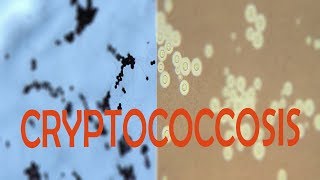 CRYPTOCOCCOSIS FUNGAL INFECTION MYCOSIS [upl. by Nataniel]