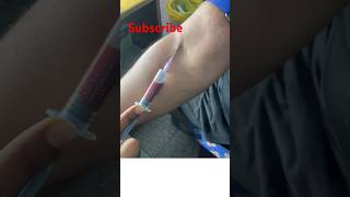 Blood Sample collection procedure aseptic techniques nursing medicalshorts injection neet2024 [upl. by Aicirtam402]