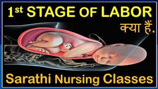 First Stage Of Labor  Stages of Labor  Stage of Cervical Dilation  By Balwant Nagar Amli sarathi [upl. by Enaoj]