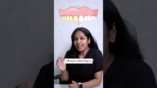 scaling or dental cleaning smiletransformation dentalclinic smiledentist dentist dentalsecrets [upl. by Junna]