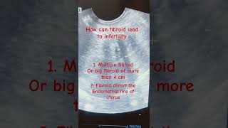 Fibroid uterus infertility trendingshortsviralsongfibroidsajnavesajnapregnancytipsfertility [upl. by Ettelloc]