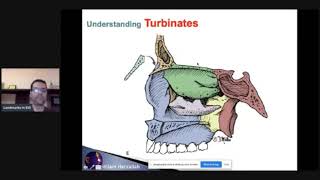 Reliable Anatomical landmarks in Endoscopic sinus surgery ProfIslam Herzallah [upl. by Kip]