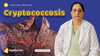 Cryptococcosis  Infectious Medicine Video Lectures  Medical Education  VLearning [upl. by Asyl]