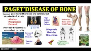 What is Pagets Disease of bone in 3 minutes Symptoms Pathophysiology and Treatment [upl. by Nodnek]