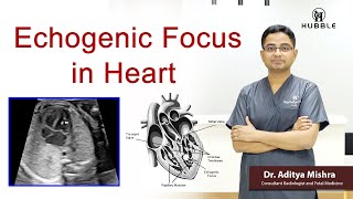 Intracardiac Echocardiography ICE [upl. by Adim]