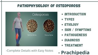 Pathophysiology Of Osteoporosis [upl. by Marrin]