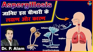 Aspergillosis  Fungal Infection  Symptoms amp Treatment  Allergic  Causes  हो जाएं सावधान health [upl. by Yarod242]