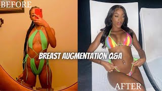 BREAST AUGMENTATION QampA  2 MONTHS POST OP  ELS B [upl. by Yretsym]