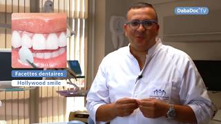 Dr Mohamed Tajmouati hollywood smile facettes dentaires [upl. by Ragan]