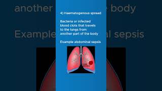 Lung Abscess  Causes of lung abscess  clinical features of lung abscess shortsvideo [upl. by Zinn]