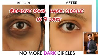 Ferulac peel for dark circle removal [upl. by Coster]