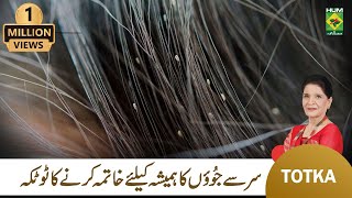 Zubaida Apa Totkay  Sar Ki Juen Khatam Karne Ka Tarika  Head Lice Removal  MasalaTv [upl. by Lombard80]