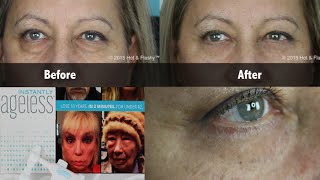 Instantly Ageless COMPLETE Review  Demo [upl. by Naitsirk593]