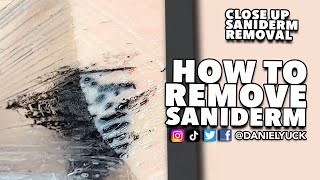 How To Remove Saniderm [upl. by Tterraj169]